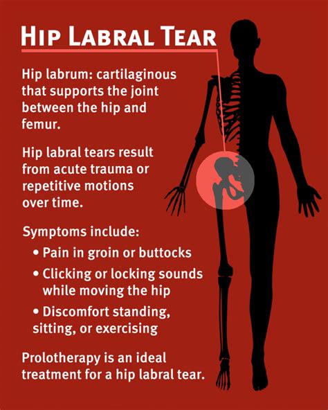 treatment for labral tear in hip